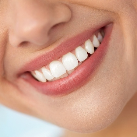 Close up of person smiling after gum disease treatment in Falls Church