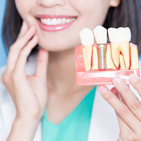 A dentist holding up a dental implant mockup