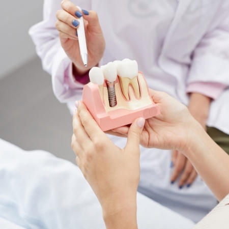 Dentist showing a model of a dental implant to a patient