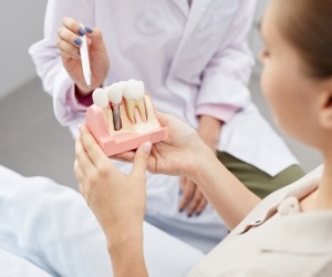 Dentist showing a model of a dental implant to a patient